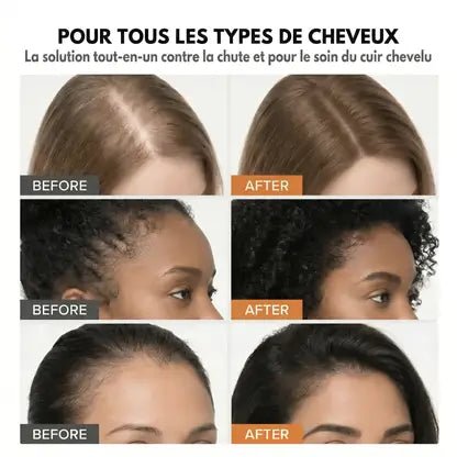 Sérum Coréen Repousse Post-Partum — Applicateur Intégré - LayaBelle